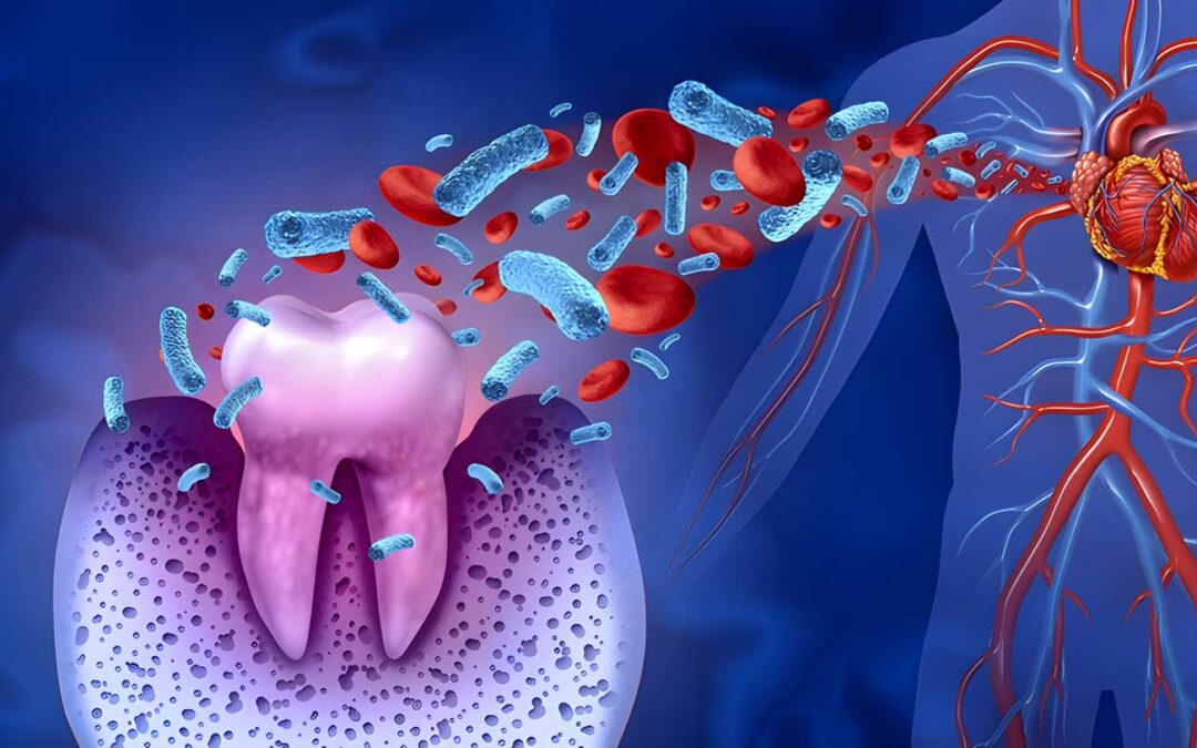 Does gum disease affect my overall health?