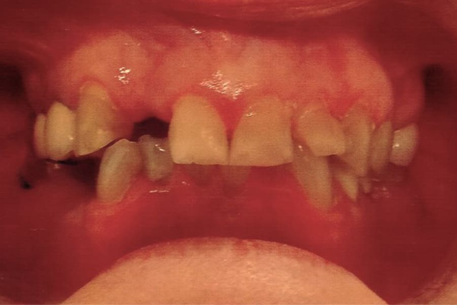 Before