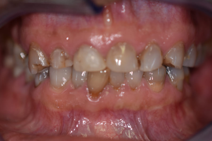 Before