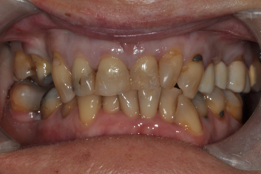 Before