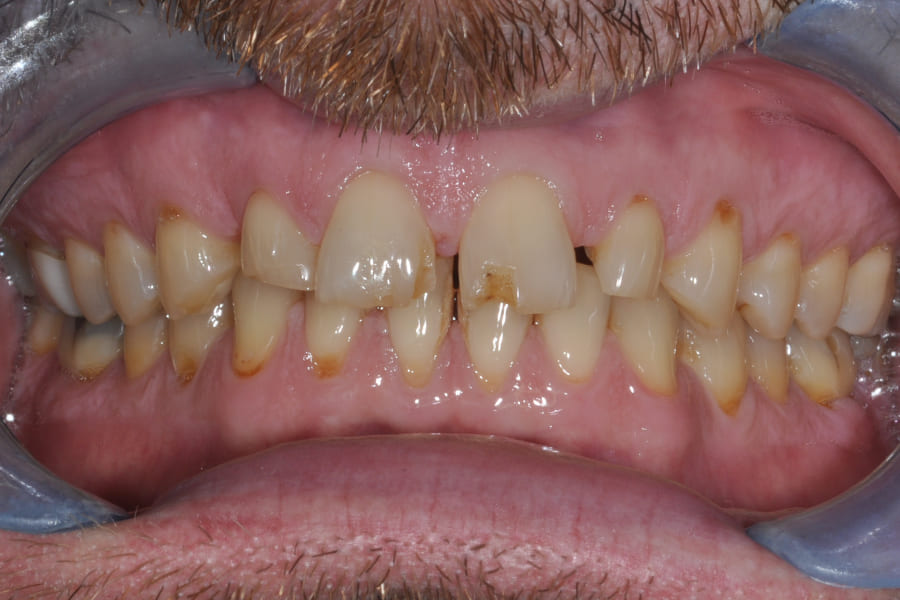 Before